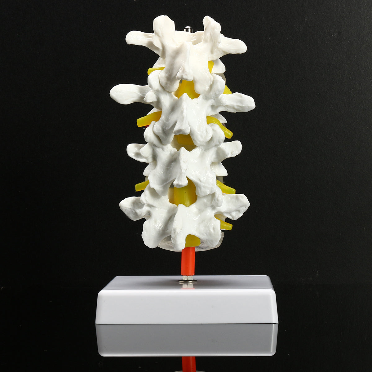 1: 1,5 Menselijke lumbale lumbale hernia model wervelkolom anatomische studie demonstratie display pedagogisch hulpmiddel